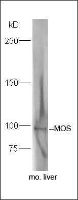 MOS antibody