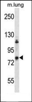 Mouse Adrbk2 antibody