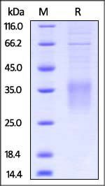 Mouse CD28 Protein, His Tag