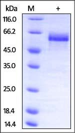 Mouse Dkk-3 Protein, His Tag