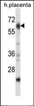 Mouse Nrbp2 antibody