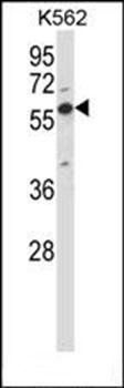 Mouse Oxsr1 antibody