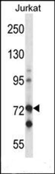 Mouse Raf1 antibody