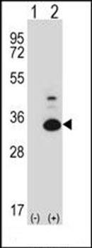 Mouse Tp53rk antibody