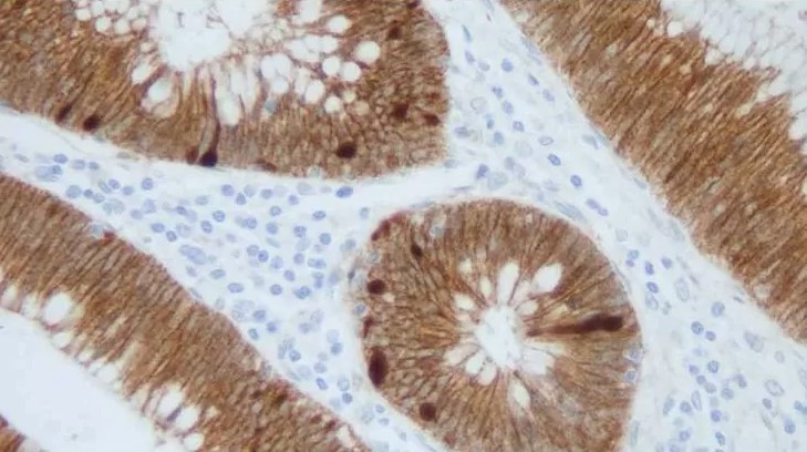 Mouse Beta-Dystroglycan, clone 43DAG1/8D5 (monoclonal) Antibody