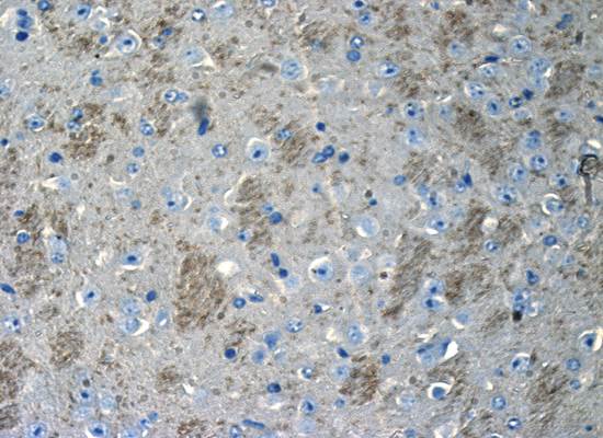 CD133 antibody