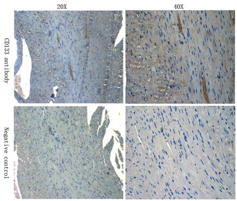 CD133 antibody