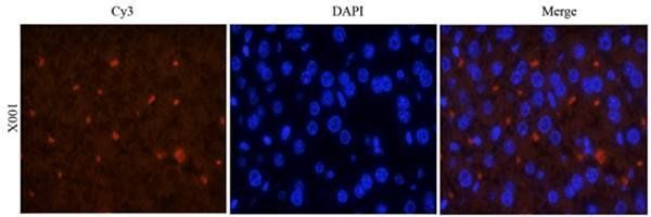 CD163 antibody