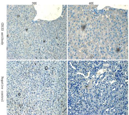 CD133 antibody