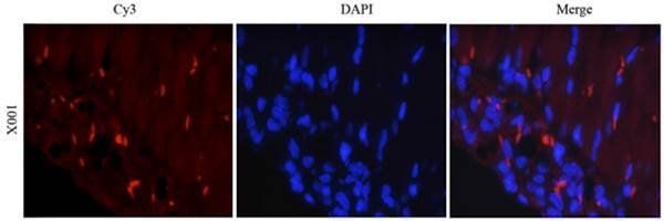 CD163 antibody