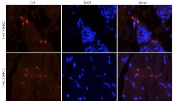 CD163 antibody