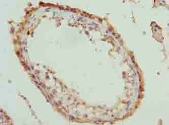 MOV10 Antibody
