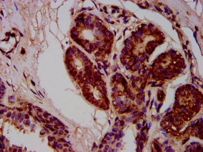 MOV10L1 Antibody