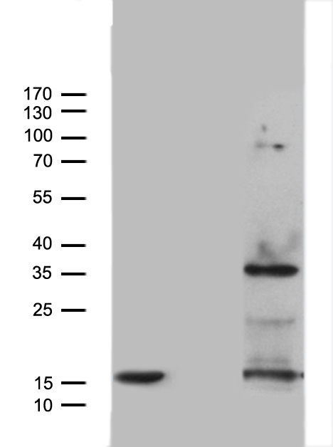 MEOX1 Antibody