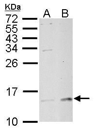 MP1 antibody [N1C3]