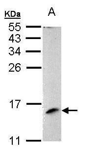 MP1 antibody [N1C3]