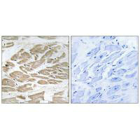 MPC1 Antibody