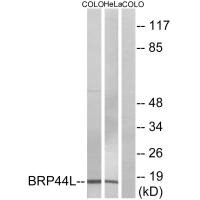 MPC1 Antibody