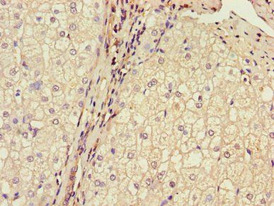 MPC2 Antibody