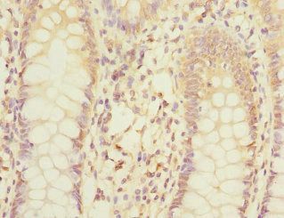 MPI Antibody