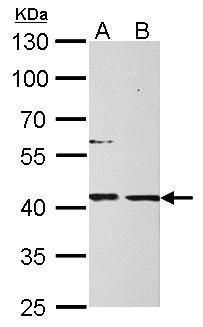 mannose phosphate isomerase Antibody