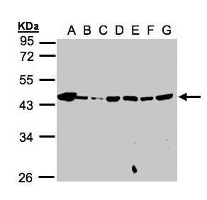 mannose phosphate isomerase Antibody