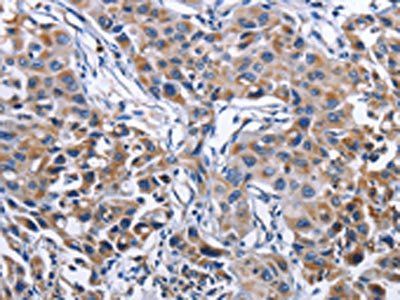 MPO Antibody
