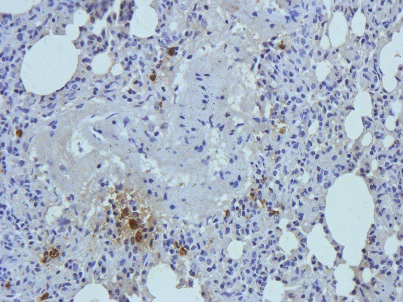 Myeloperoxidase antibody