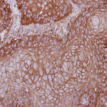 MPP1 Rabbit Polyclonal Antibody