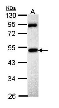 MPP1 Rabbit Polyclonal Antibody