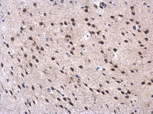 MPP3 antibody [N1C1]