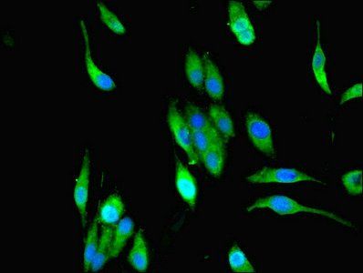 MPPED1 Antibody