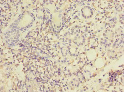 MPPED1 Antibody