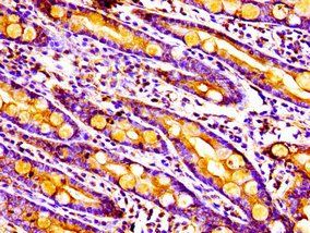 MPST Antibody