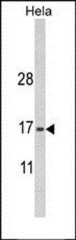 MPV17 antibody