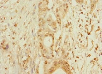 MPZL2 Antibody