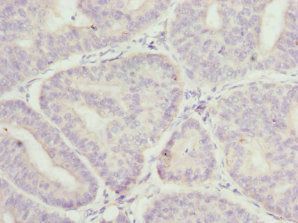 MR1 Antibody