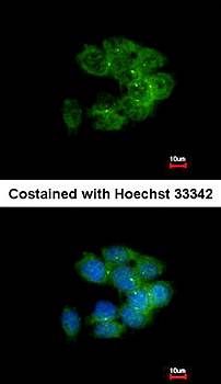 MRCKalpha Rabbit Polyclonal Antibody