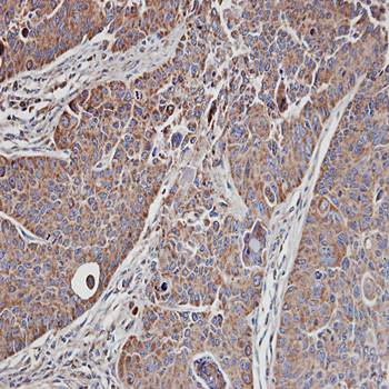 MRCKalpha Rabbit Polyclonal Antibody