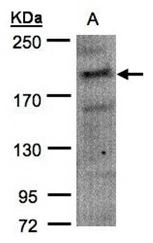 MRCKalpha Rabbit Polyclonal Antibody