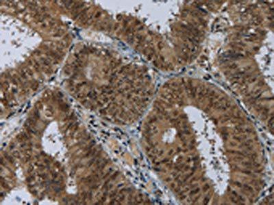 MRE11A Antibody
