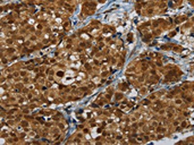 MRE11 Antibody