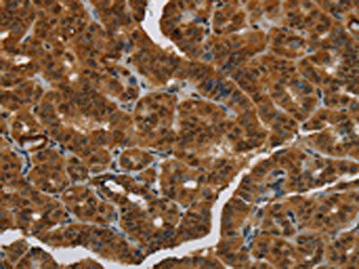 MRE11 Antibody
