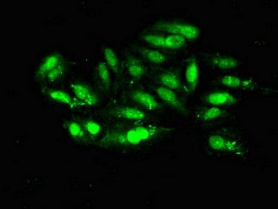 MRE11A antibody