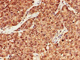 MRE11A Antibody