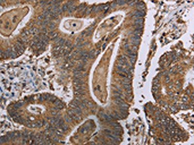 MRGPRX1 Antibody