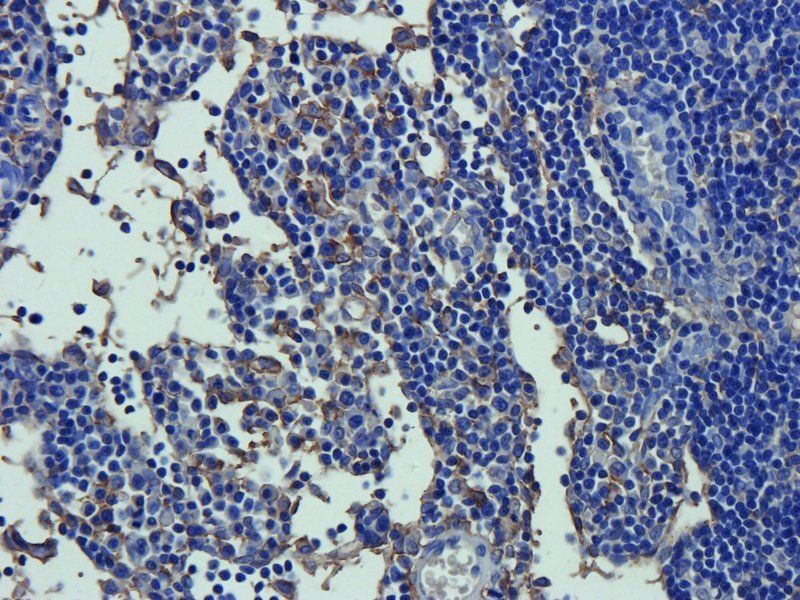 MRP2 antibody