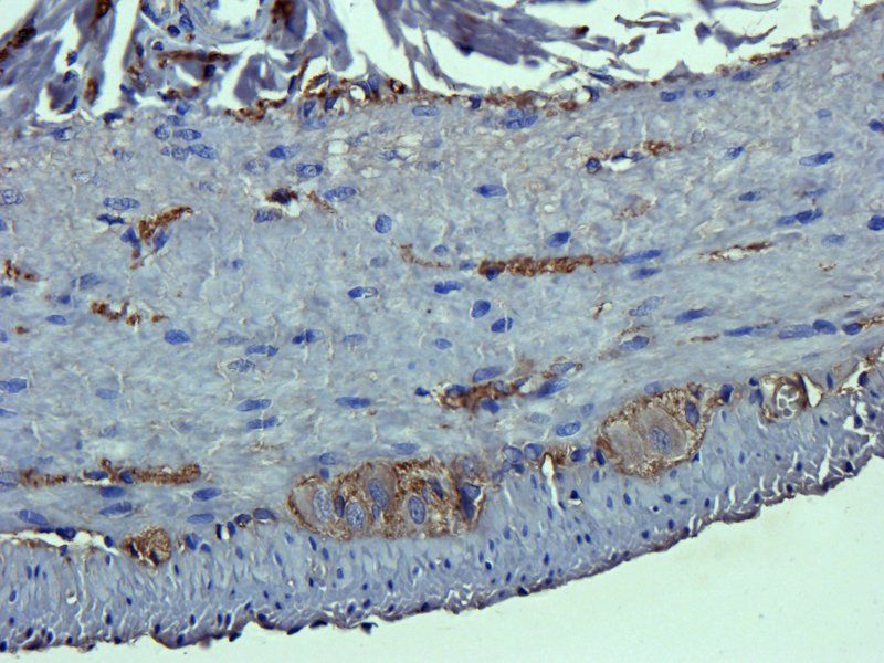 MRP2 antibody