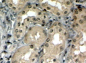 Goat anti-MRP5 Antibody