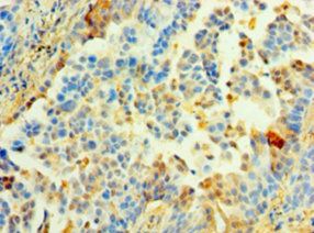 MRPL1 antibody